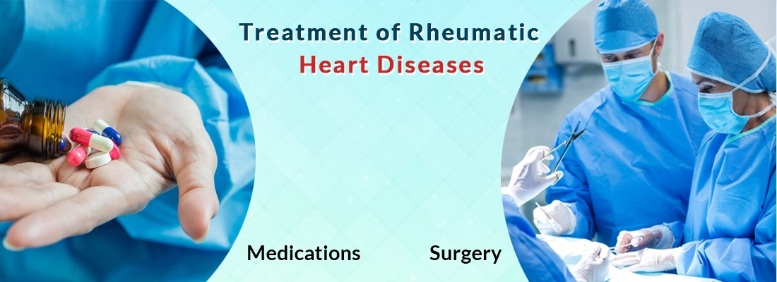 Treatment of Rheumatic Fever